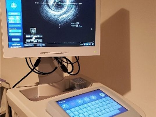 超音波機器のある機能訓練室  