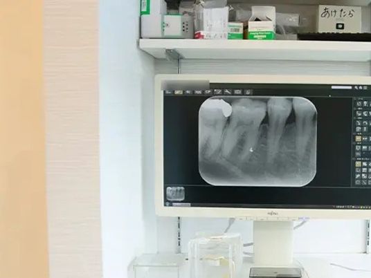 歯科用モニターのある診療室  