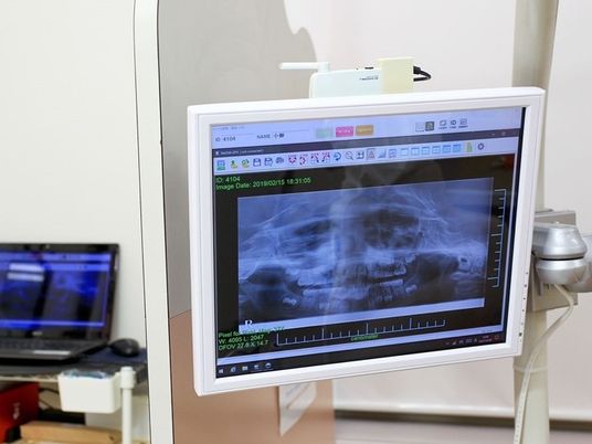 X線表示モニターの機能訓練室  