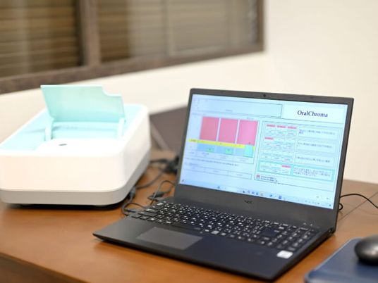 口腔機器のある机  
