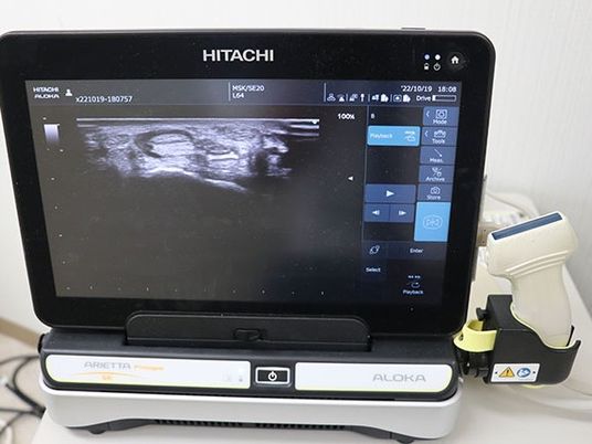 検査機器の画面と本体  